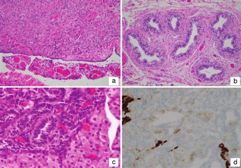 Histopathological findings of gonadal tissue. (a) The right (shown) and... | Download Scientific ...