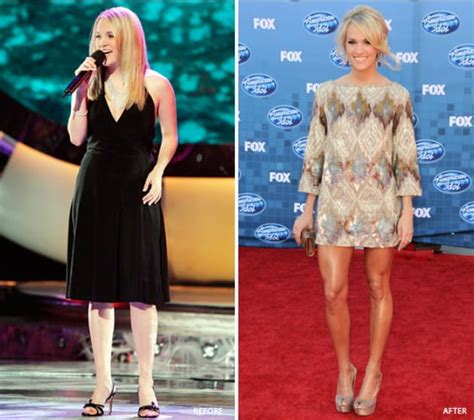 These Stars Underwent Gastric Sleeve Surgery And The Results Are ...