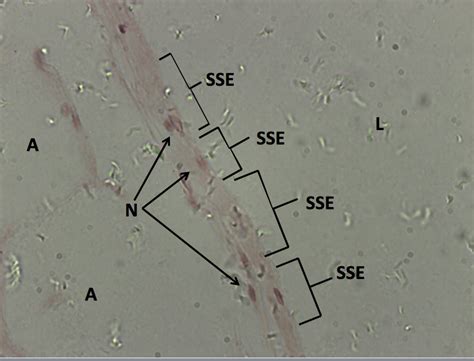 Tongue with Taste Buds - 10x | Histology