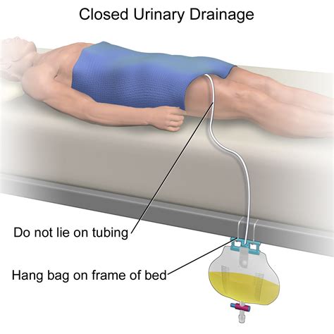 Urinary Catheterization; Catheterization, Urinary; Catheterization, Ureteral; Catheterization ...