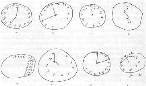 How To Interpret The Clock Drawing Test