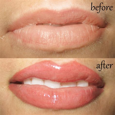 Permanent Makeup Lips Before And After - Makeup Vidalondon