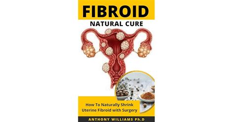 FIBROID NATURAL CURE: Trusted Guide to Shrinking Uterine Fibroid Naturally without Surgery by ...