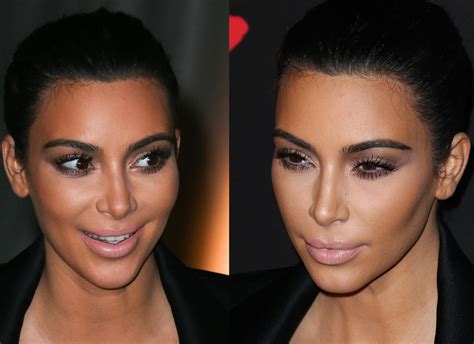 Kim Kardashian Explains Why She Rarely Smiles—Find Out Why!