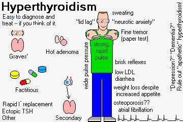 10 Most Common Side Effects of Lithium