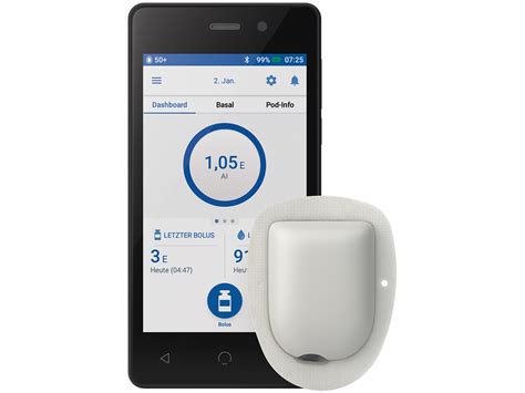 Omnipod® Insulinpumpentherapie, vereinfacht