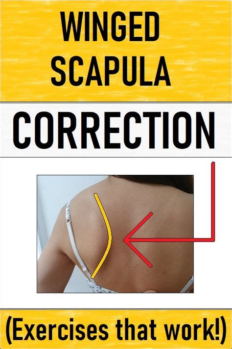 10 Winged Scapula ideas in 2021 | winged scapula, scapula, scapula ...