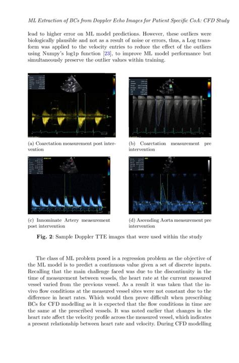 Machine Learning based Extraction of Boundary Conditions from Doppler ...