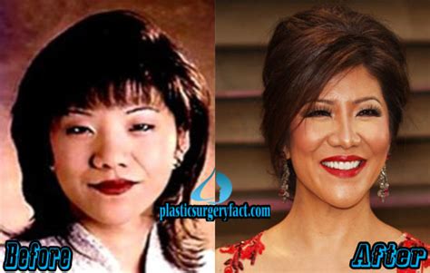 Julie Chen Plastic Surgery Before and After Photos