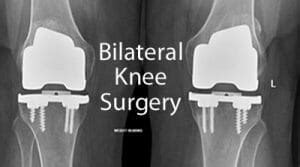 Bilateral Knee Replacement Surgery - X10 Therapy