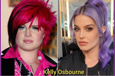 Kelly Osbourne Before And After Plastic Surgery