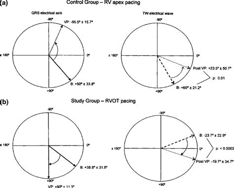 Memory-induced changes in T wave electrical axis after pacing from ...