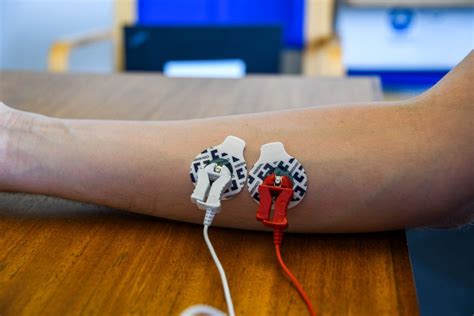 What Is EMG (Electromyography) and How Does It Work?