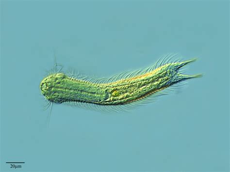 Phylum Gastrotricha