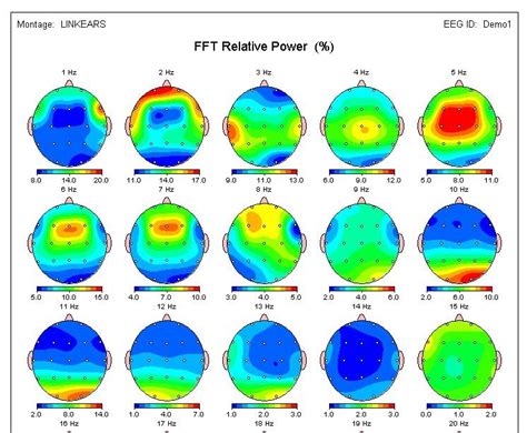 QEEG: 3 Ways a Brain Map Can Help - Denver Englewood Counseling | Highlands Ranch Therapy