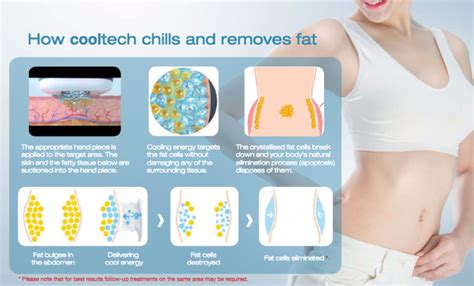 Freezing Fat Cells At Home Before And After Photos | Taraba Home Review