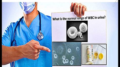 WBC in Urine - High Count Causes - YouTube