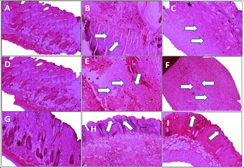 Histology of un-wounded control, un-illuminated control and 2 J/cm 2... | Download Scientific ...