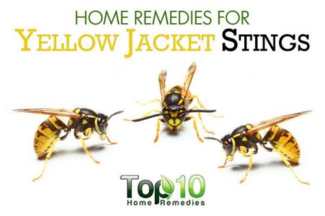 Home Remedies for Yellow Jacket Stings | Top 10 Home Remedies