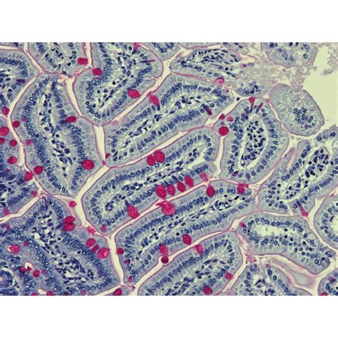 PAS (Periodic Acid-Schiff)-Harris Hematoxylin Histology Stain