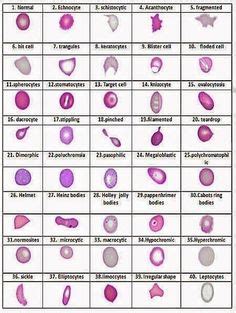 17 Hematology Slides ideas | hematology, medical laboratory technician ...