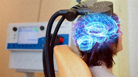 Repetitive transcranial magnetic stimulation significantly decreases post-stroke depression by ...