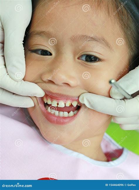 Close-up Little Girl during Dental Extraction. Child with a Teeth ...