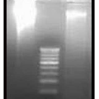 DNA Fragmentation assay. The fragmented DNA observed under UV light... | Download Scientific Diagram