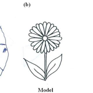 (PDF) Hemispatial neglect: clinical features, assessment and treatment