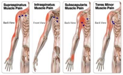 Shoulder Pain Caused By The Rotator Cuff - Mobile Massage & Personal Training