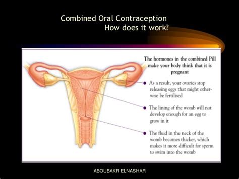 Risks & benefits of combined oral contraceptive pills