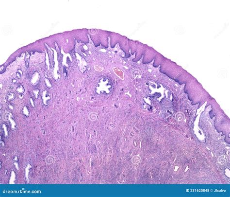 Human Endocervix. Squamous Metaplasia Royalty-Free Stock Image | CartoonDealer.com #231620860