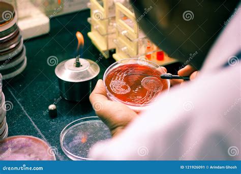 Bacterial Inoculation In Laboratory Dishes, Grown Colonies Of Bacteria Or Fungi Stock Image ...