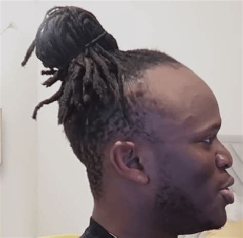 KSI: Yo I'm sure my hairline is fine" KSI's hairline..... : r/Sidemen