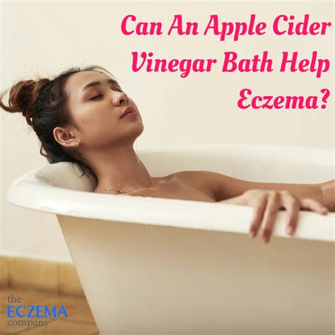 Can An Apple Cider Vinegar Bath Help Eczema? (Stop Bathing in Bleach)