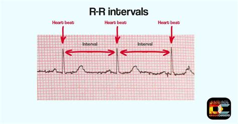 Garmin HRV: Everything you need to know.