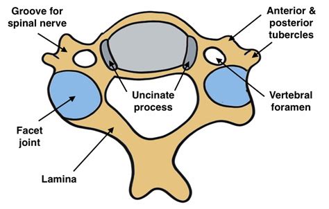 Cervical Radiculopathy | The Bone School