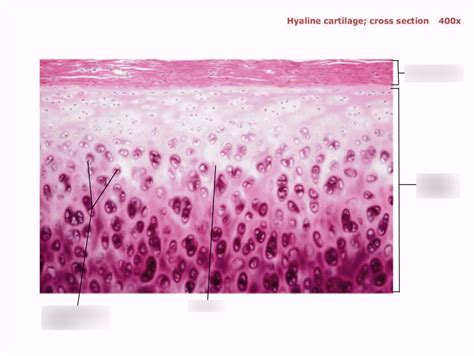 Hyaline cartilage; cross section 400x Diagram | Quizlet