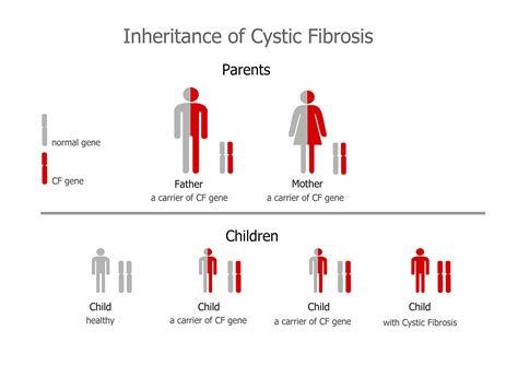 What is Cystic Fibrosis? – Cystic Fibrosis DNA