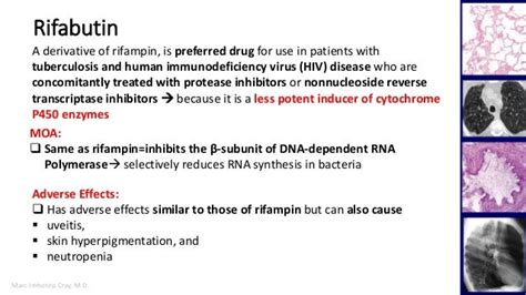 Pulmonary tuberculosis pharmacology