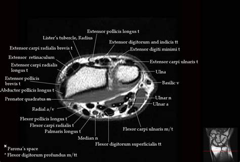 Wrist Compartment Anatomy