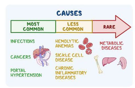 Cause of Splenomegaly - MEDizzy