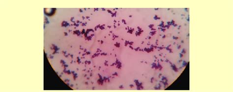 Gram's stain of Kocuria spp showing large sized cocci arranged in... | Download Scientific Diagram