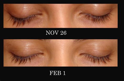 Castor oil eyebrows before and after | Castor oil eyebrows, Castor oil lashes, Eyebrow before ...