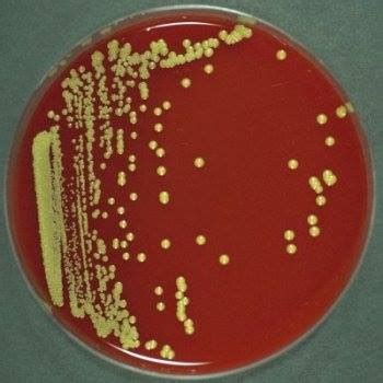 Micrococcus luteus | Medical Laboratories