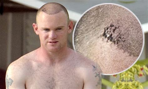 Wayne Rooney hair transplant results revealed on Barbados holiday | Daily Mail Online