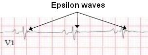 50 Cardiology Pimp Questions | LearntheHeart.com