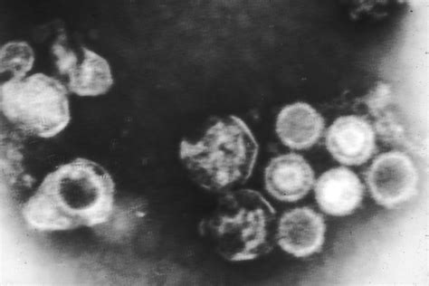 Electron micrograph of Epstein-Barr virus | Biology of Human/World of ...