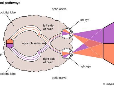 Optic neuritis | pathology | Britannica