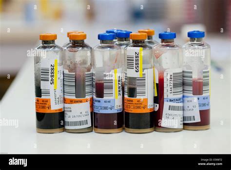 Blood culture bottles, Bacteriology laboratory Stock Photo - Alamy